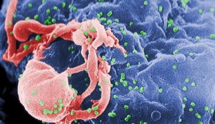 Consiguen controlar la infección por VIH con terapia génica