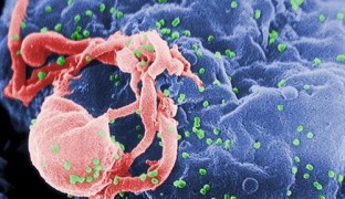 Investigan a un paciente que podría tener la 'clave' de la vacuna del VIH