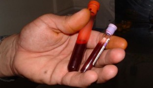 Los bisexuales tienen más riesgo de contraer una ETS