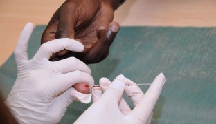 El genotipo de cada persona influye en la efectividad de la vacuna contra el VIH